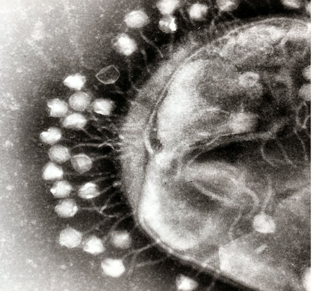 Mircoscopic view of pathogen