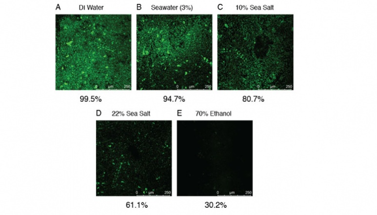 Five confocal microscopy images with bright green signaling depicting biofilm. 