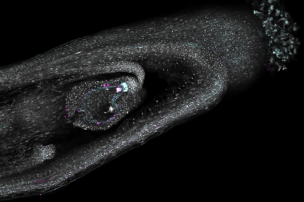 Microscope image of a developing seed in an Arabidopsis thaliana silique.
