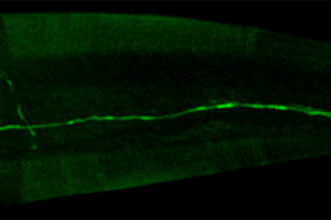 Worm cells glowing green on black background