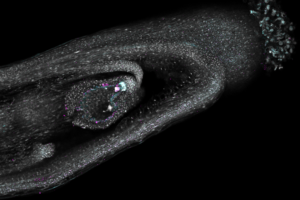 Microscope image of a developing seed in an Arabidopsis thaliana silique.